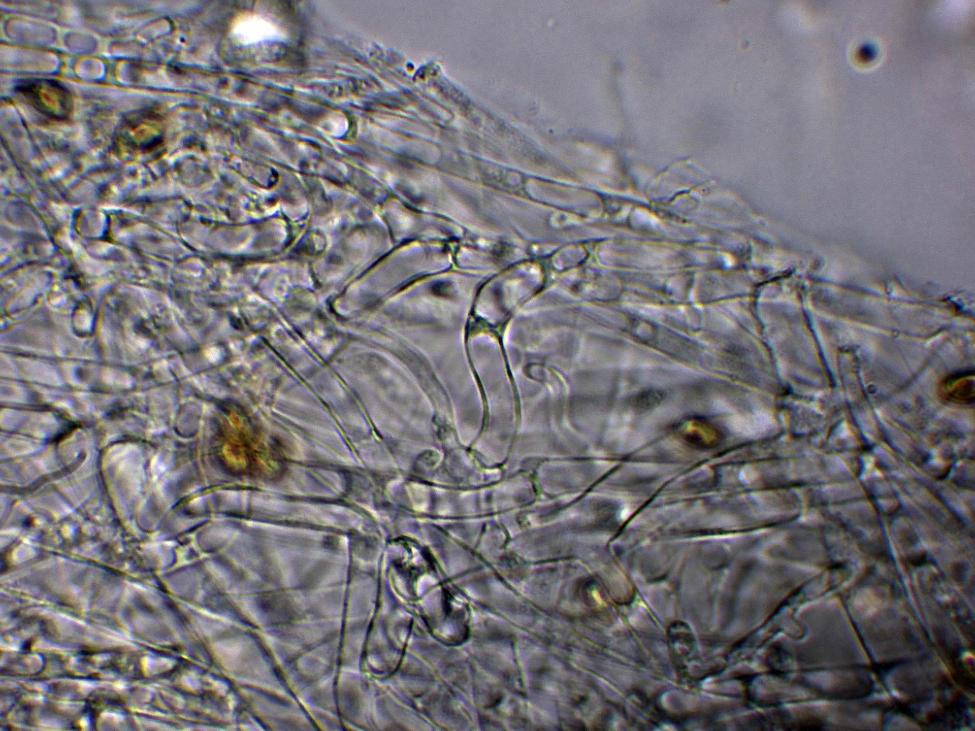 10 - Suprapellis agua-004